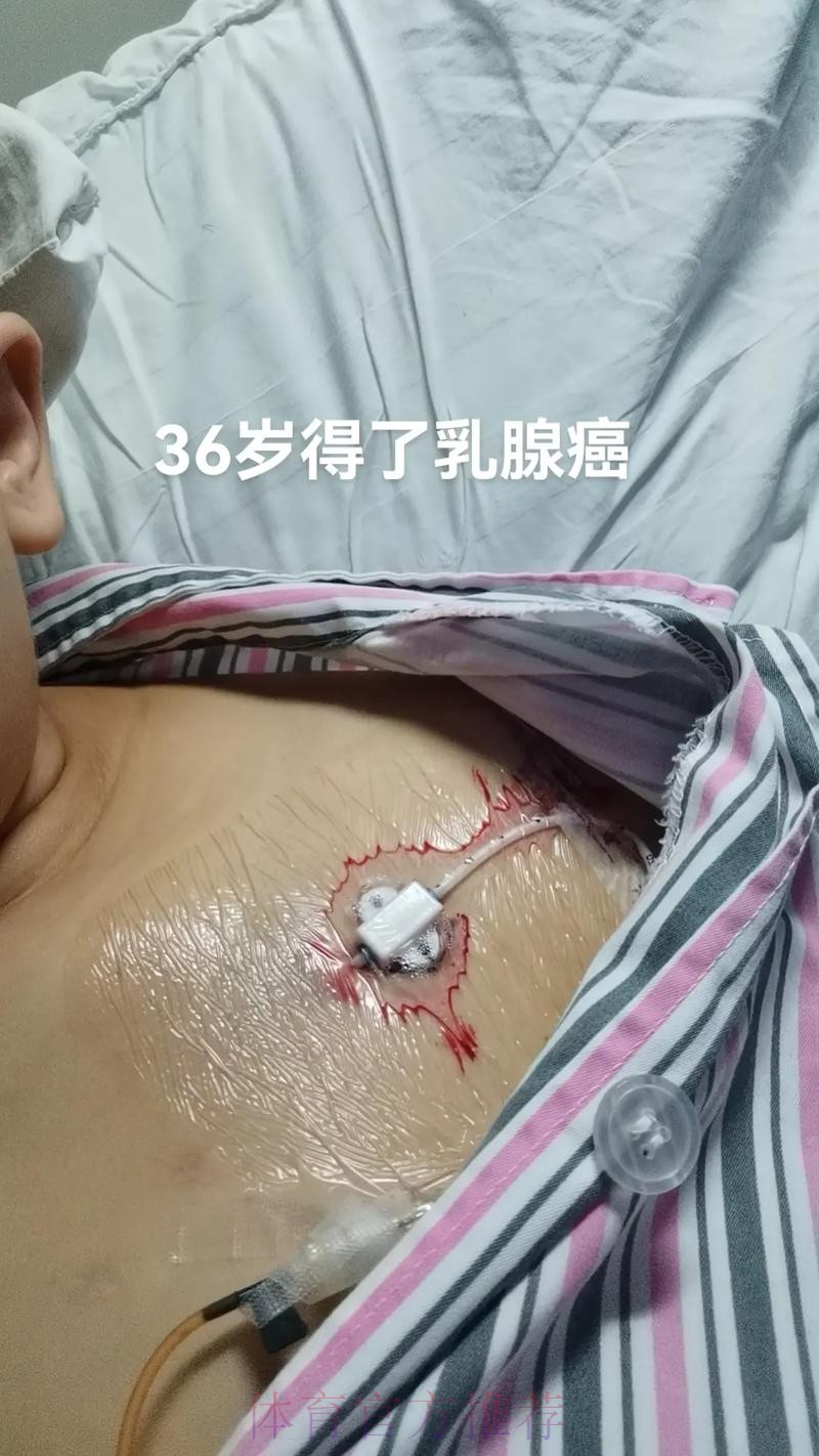 荷兰队主帅宣布辞职：妻子正与乳腺癌抗争，世间还有比足球更重要的事